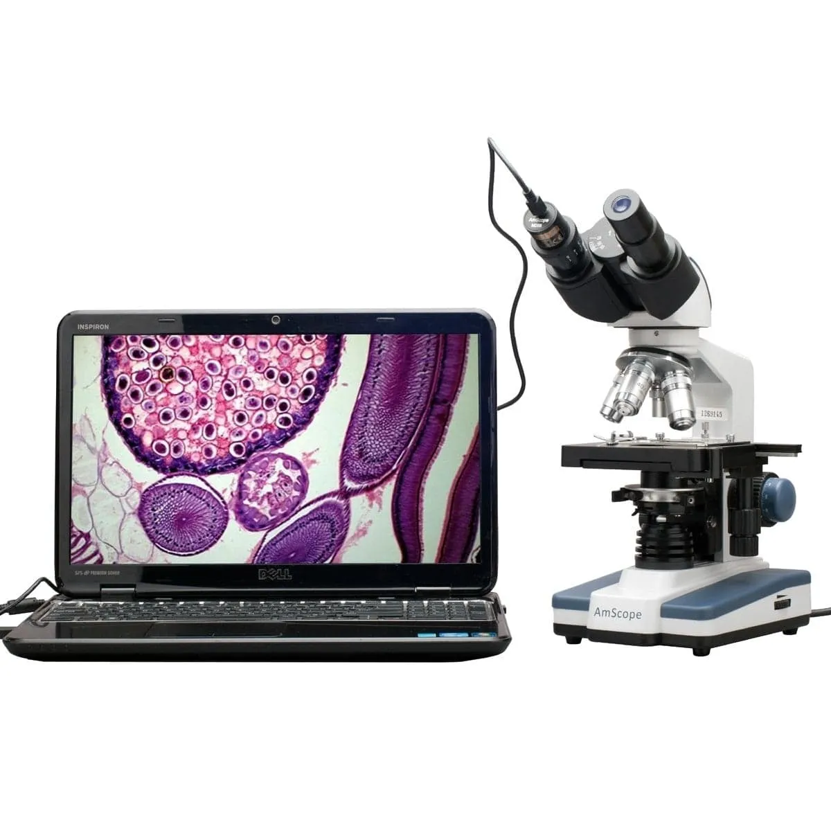 AmScope B120 Series Binocular Compound Microscope 40X-1000X Magnification with LED, Siedentopf Head and 3MP Digital Camera