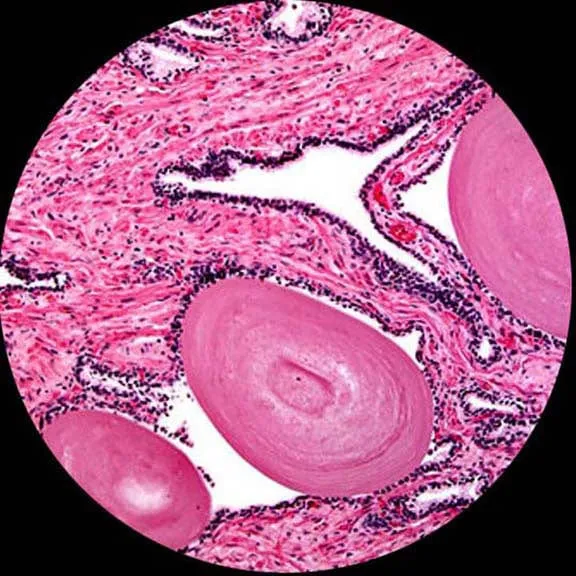 AmScope B120 Series Binocular Compound Microscope 40X-2000X Magnification with LED, Siedentopf Head, 2MP Digital Camera and 3D Stage